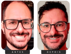 Grupo 1