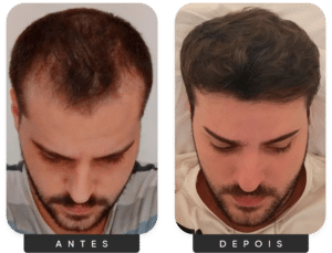 Grupo 11