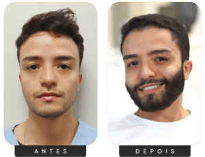 Grupo 4