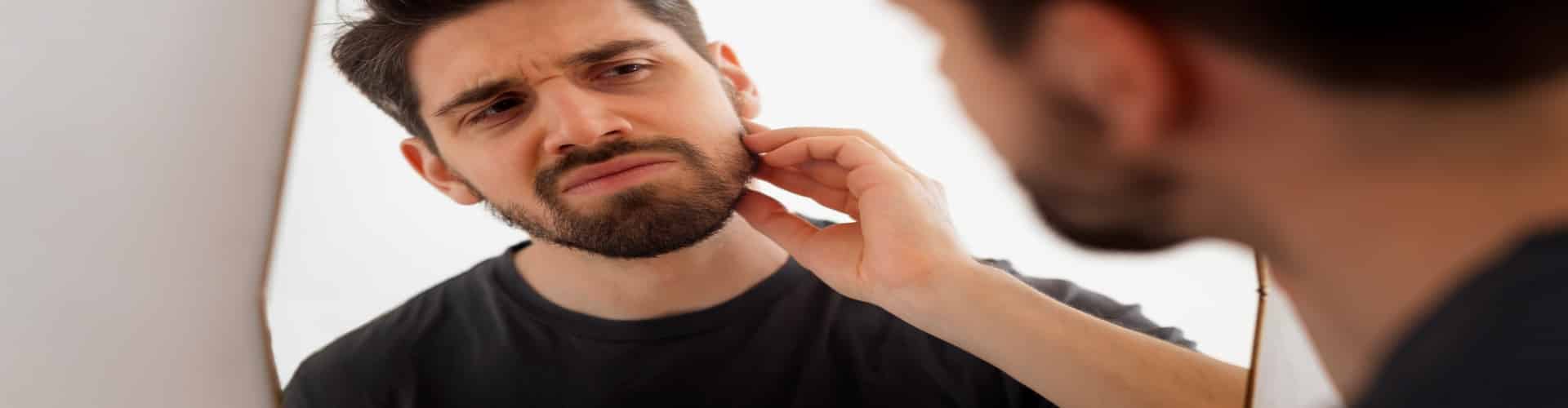 Alopecia na Barba: Entenda as Causas, Sintomas e Tratamentos Eficazes