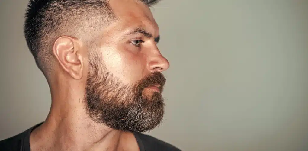 Alopecia Areata na Barba: Entenda as Causas, Sintomas e Tratamentos