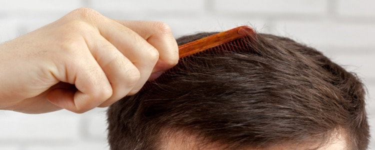 Alopecia: Dicas e Tratamentos para Fortalecer Seus Cabelos