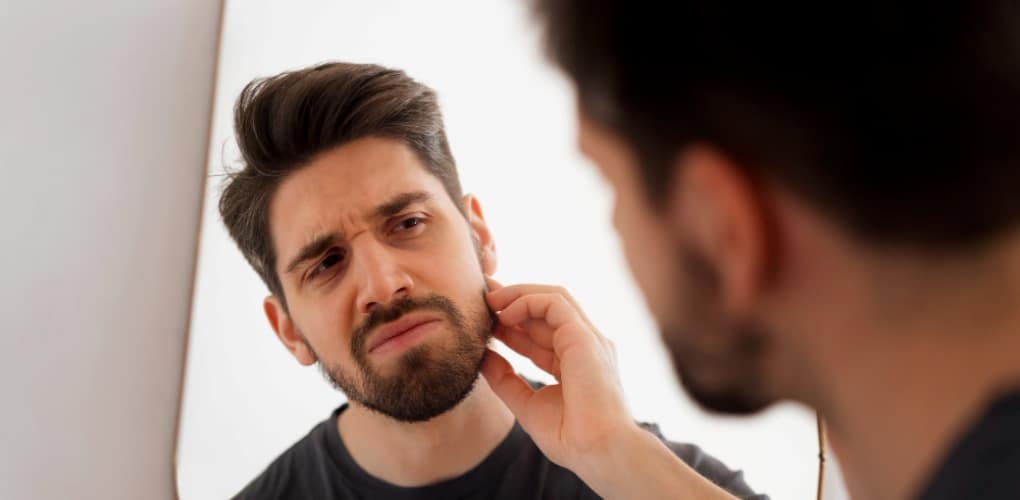 Guia Completo do Implante de Barba: Procedimentos, Resultados e Cuidados Essenciais