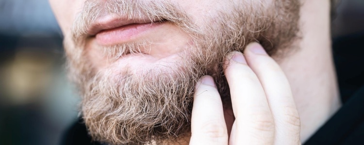 Tratando Psoríase na Barba: Dicas e Soluções Eficazes