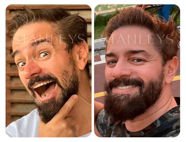 Antes-e-Depois_LP-20.png