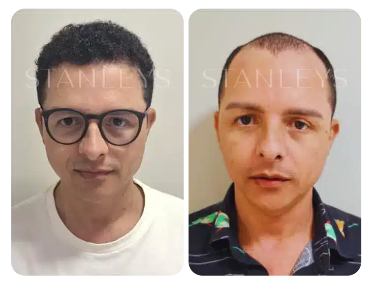antes_e_depois_lp_02_2x.webp